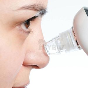 Máquina de Limpieza Facial Succión de Vacío