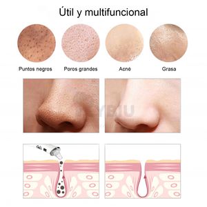 Máquina de Limpieza Facial Succión de Vacío