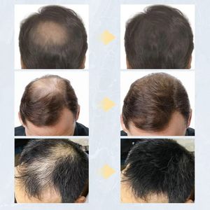 Cabello Instantáneo Hm Hair Fiber Negro Genieka