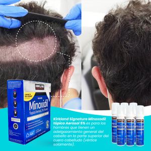 Minoxidil Espuma Kirkland 60ml 3 Unidades