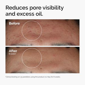 The Ordinary sérum Niacinamide 10% + Zinc 1% piel con imperfecciones | 30 ml.